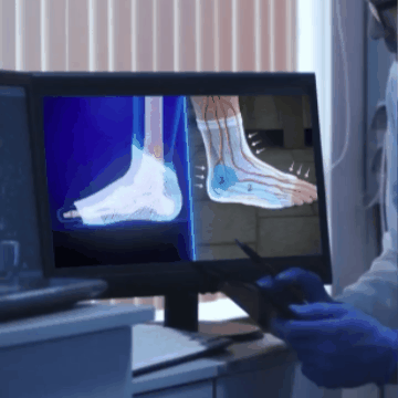 Calcetines De Neuro Compresión