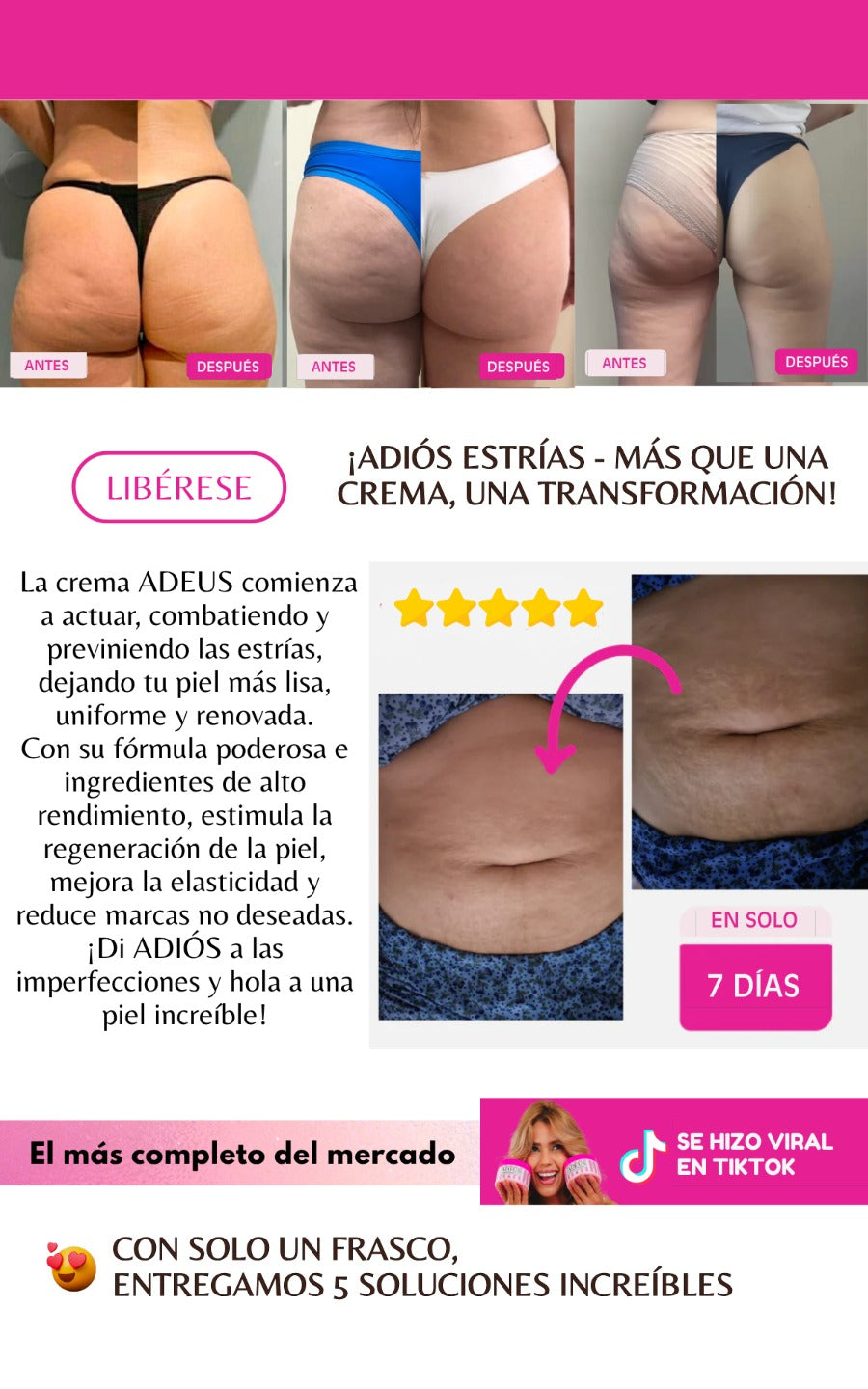 ADEUS || CREMA ANTI ESTRIAS