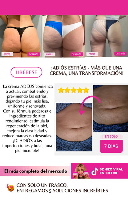 ADEUS || CREMA ANTI ESTRIAS